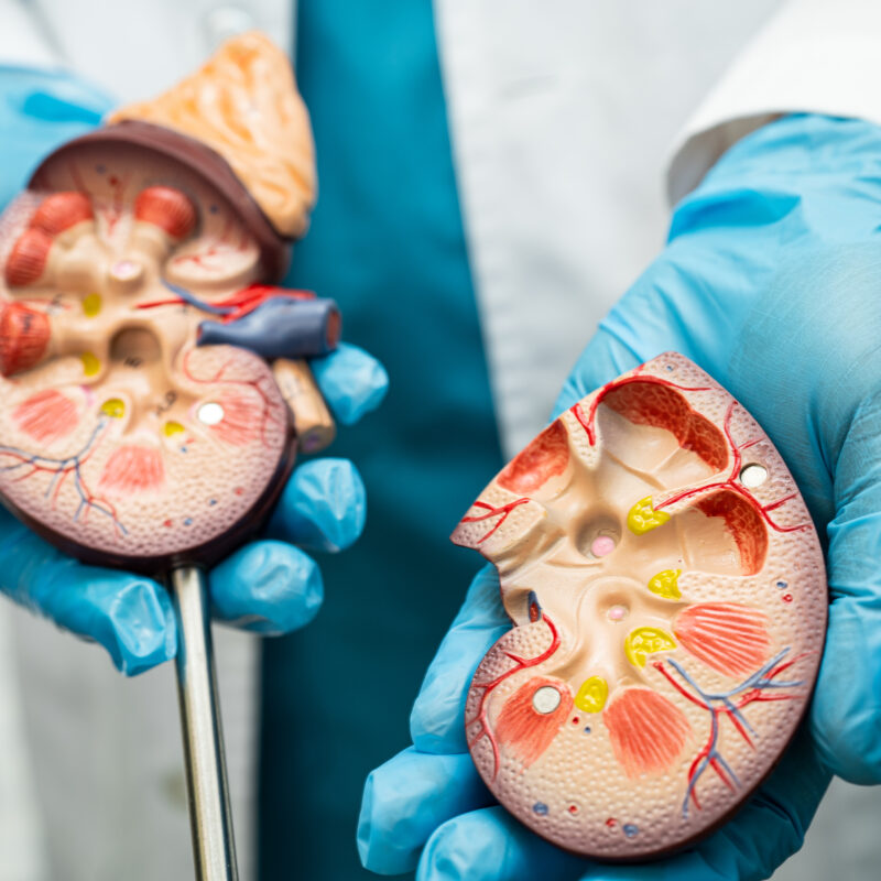 The Role of Transplant in ESRD: Is It Right for You?